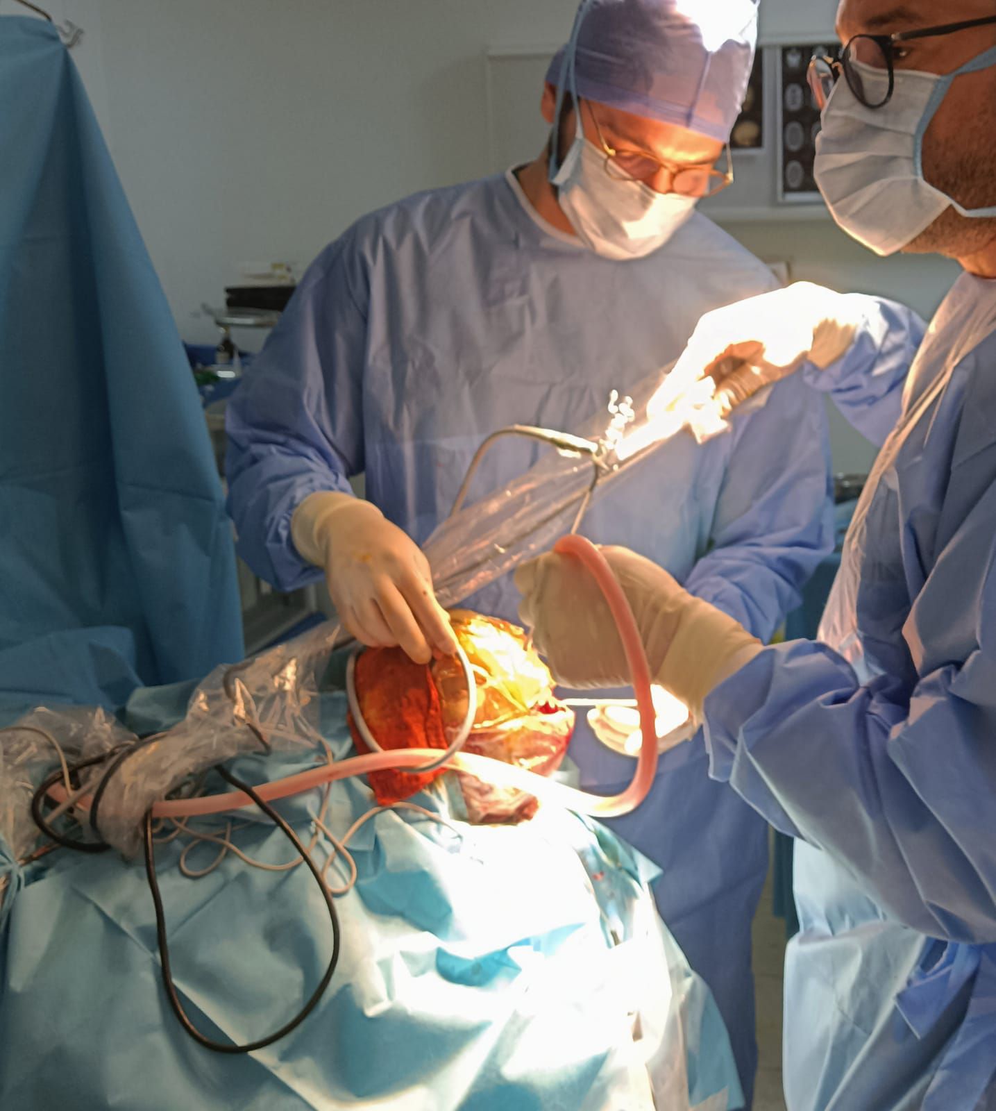 إنجاز جديد للطب التونسي: نجاح 3 عمليات دقيقة في جراحة الأعصاب للرضع